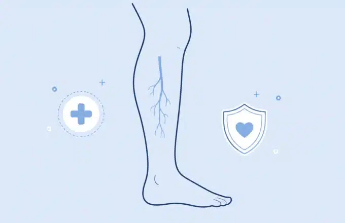 The Silent Clot: Recognizing DVT Before It’s Too Late